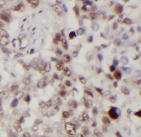 Phospho-AMPKA1(T183)/AMPKA2(T172)抗體