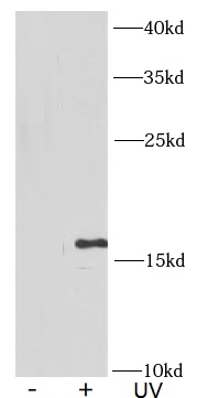 anti- γ-H2AX antibody圖像