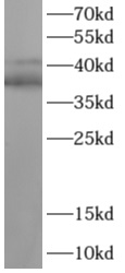TAL1抗體