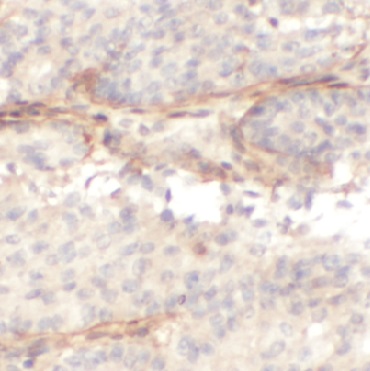 Fibronectin抗體