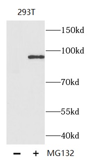 Phospho-β-Catenin (S33/S37/T41)抗體