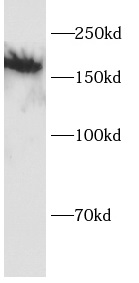 CD11a抗體