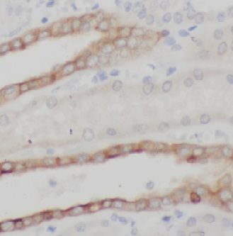 Cytokeratin 7抗體