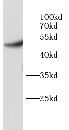 PDK1抗體