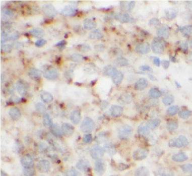 Cathepsin B抗體