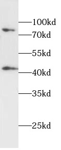 androgen receptor 抗體