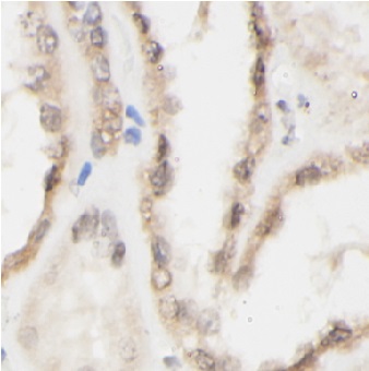 CD154抗體