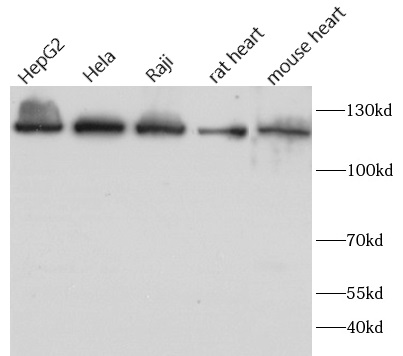 ATP citrate lyase抗體
