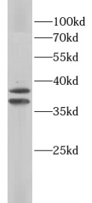 AMPK gamma 1抗體