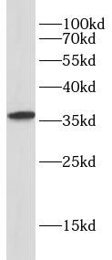 Endomucin抗體