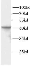 CSNK2A1抗體