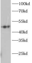 GSK3A抗體