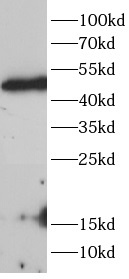HDAC8抗體