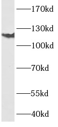 Integrin alpha 6抗體