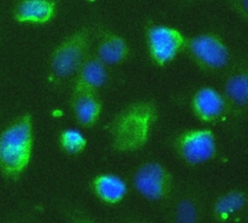      anti-irak2 antibody