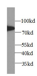 5 Lipoxygenase抗體