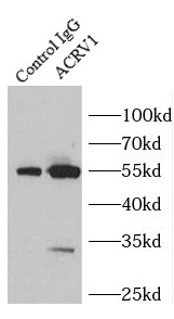 ACRV1抗體