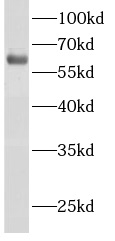 ACSM2A抗體