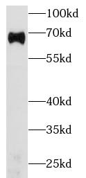 anti- Albumin antibody