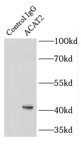      anti- ACAT2 antibody