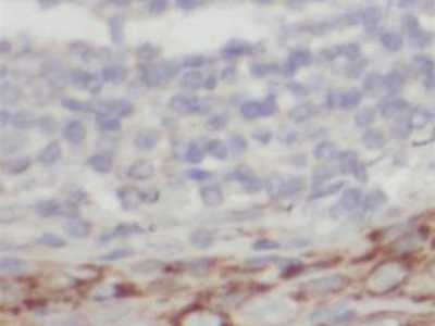 alpha 1 Antichymotrypsin/AACT抗體