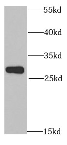anti- ANP32A antibody