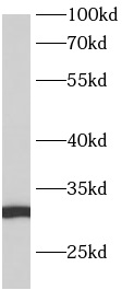 ANKRD7抗體