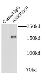 ANKRD50抗體