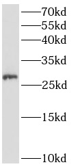 ANKRD49抗體