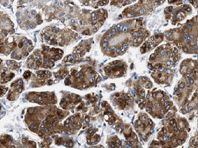 Apolipoprotein AI抗體