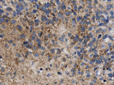 Antizyme inhibitor 1抗體
