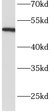Antithrombin III抗體