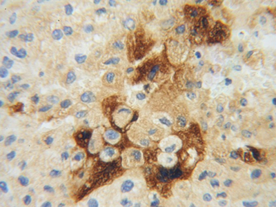 Apolipoprotein H抗體