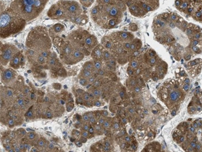 Apolipoprotein A II抗體