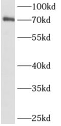 ALX3抗體