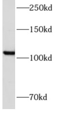  AMOTL1抗體
