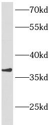 ANKRD1抗體