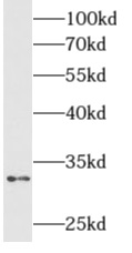 ALKBH4抗體