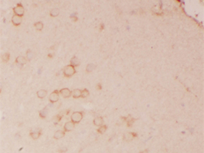 ATP1B2抗體