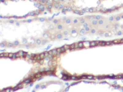 ATP5C1抗體