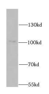      anti- ATP2C1 antibody