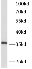      anti- AIDA antibody