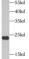      anti- AK1 antibody