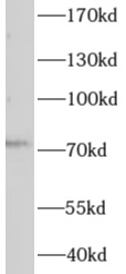      anti- AGBL3 antibody