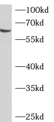 ADAD2抗體