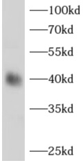 ADH1B抗體