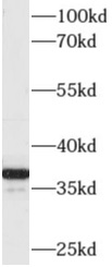 AKR1C4抗體