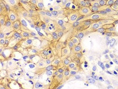 ACTA2/smooth muscle actin抗體