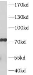 AKAP8L抗體