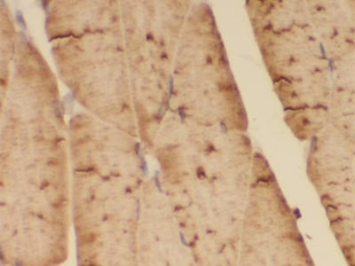 ACTA1-Specific抗體